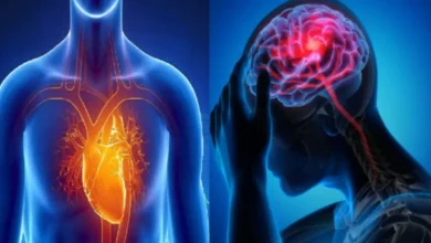 7 ways to reduce the risk of stroke